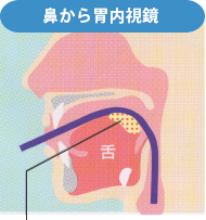 鼻から胃内視鏡